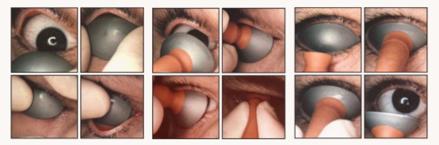 Protectores Oculares 4 - Midis Laser
